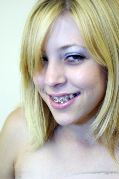 teen braces hot xxx images