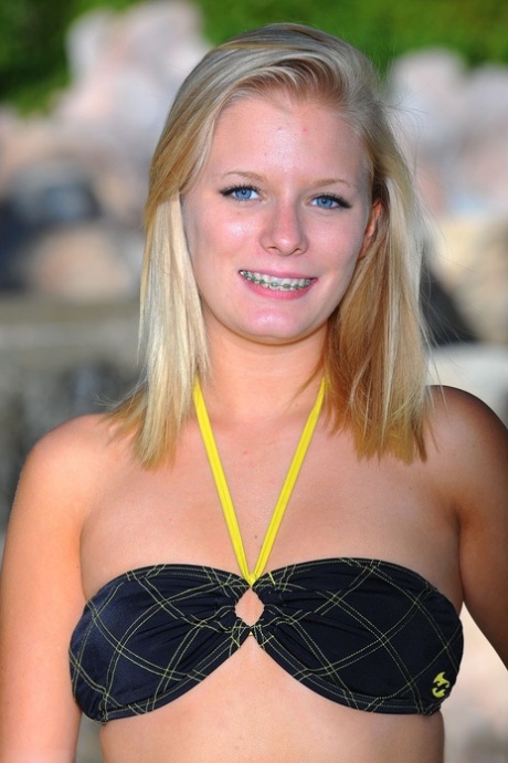 teen braces free gallery